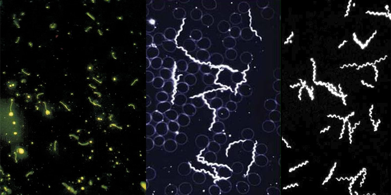 Трепонема паллидум темнопольная микроскопия. Бледная трепонема риф. Микроскопия трепонемы. Трепонема микроскопия. Бледная трепонема романовский гимзе.