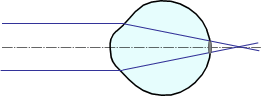 www_microsystemy_ru_articles_Eye_as_an_optical_tool