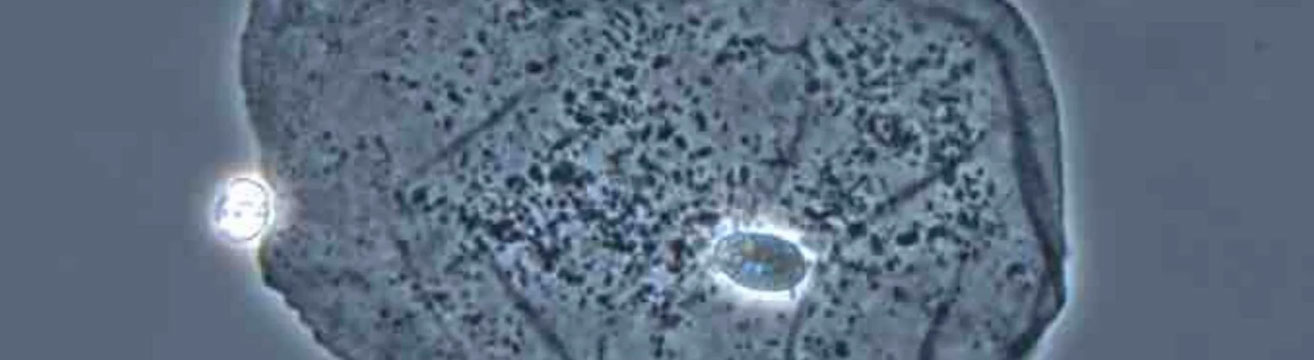 Методы контраста в световой микроскопии (I часть) — Микросистемы